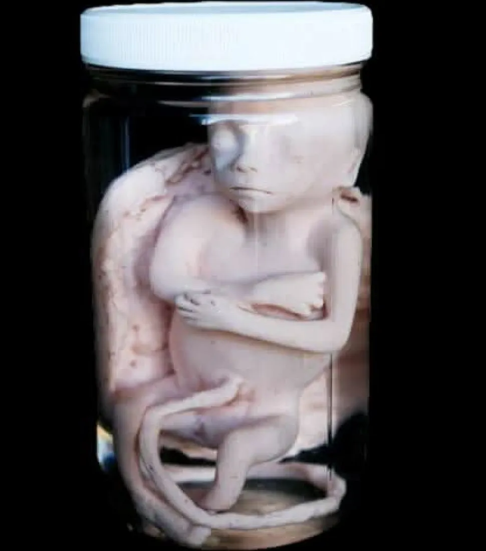 Fetus Replica 5 months Specimen Jar Halloween Prop