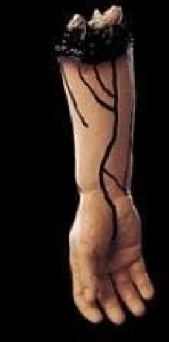 Severed Right Arm Bloody Body Part Halloween Prop