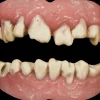 Zombie Teeth